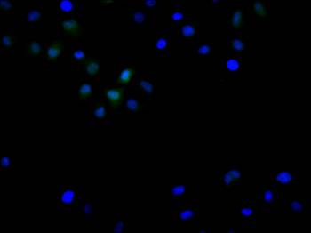 S100P Antibody