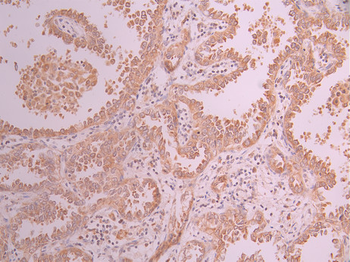 CLPTM1 Antibody