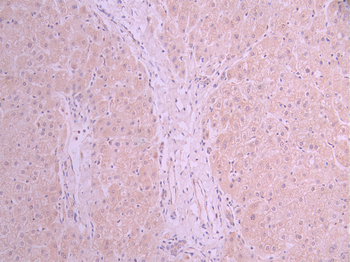 AGL Antibody