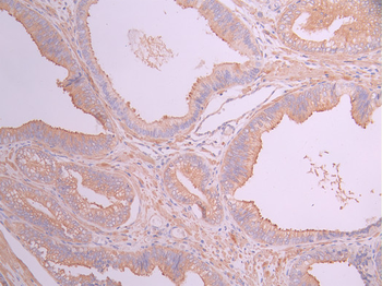IL11RA Antibody