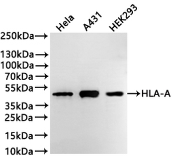 HLA-B&HLA-A Antibody