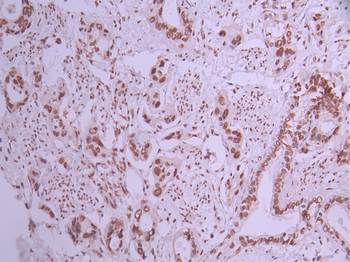 TAF15 Antibody