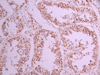 TAF15 Antibody