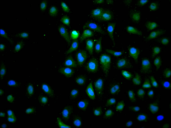 CTCF Antibody