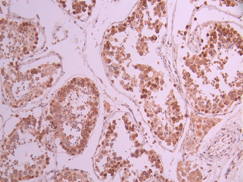 SMC3 Antibody