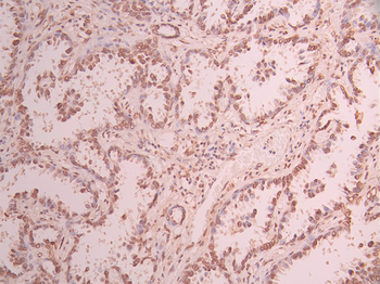 NPM1 Antibody