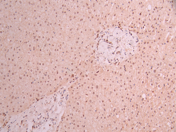 NPM1 Antibody