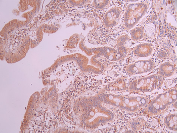 DCLK1 Antibody