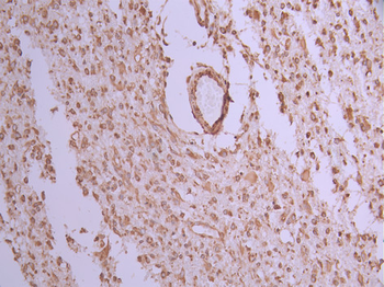 UBA52 Antibody