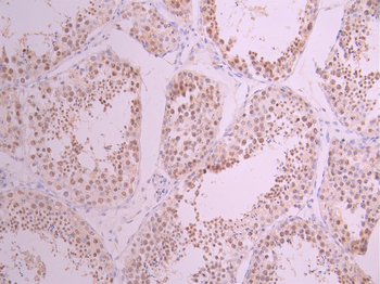 MCM2 Antibody