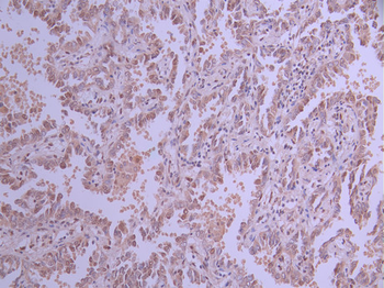 TP53BP1 Antibody