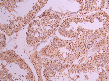 TP53BP1 Antibody