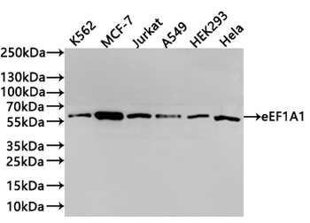G6PD Antibody