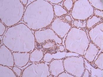 RBM3 Antibody