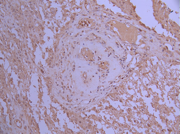 DTYMK Antibody