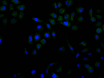DTYMK Antibody