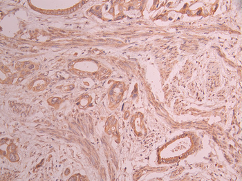 EXOC3 Antibody