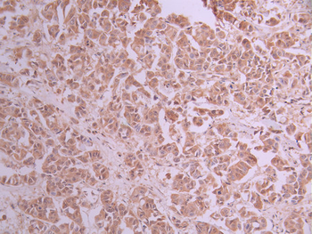 KIF5B Antibody