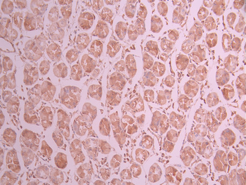 KIF5B Antibody