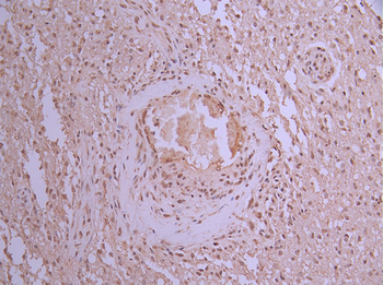 HNRNPA1 Antibody