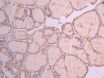 HNRNPA1 Antibody