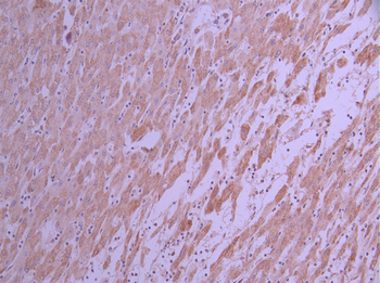 AK2 Antibody