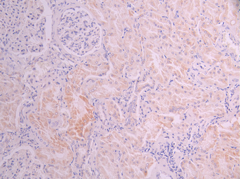 AK2 Antibody