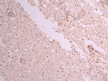 MEF2A&MEF2C Antibody