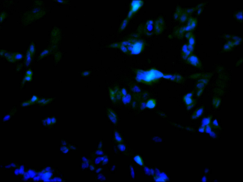 RAVER2 Antibody