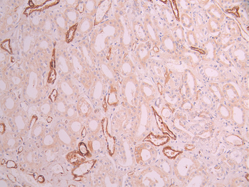 CRYAB Antibody