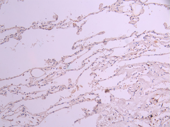EIF1AX Antibody