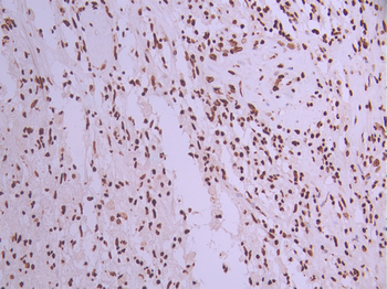 HNRNPM Antibody