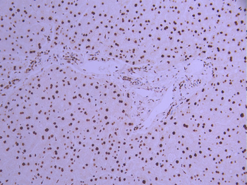 HNRNPM Antibody