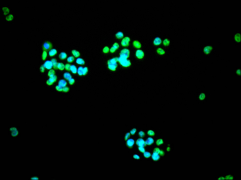 HNRNPM Antibody