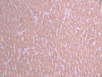 HSD17B10 Antibody