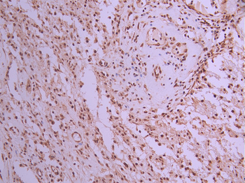 MTA2 Antibody