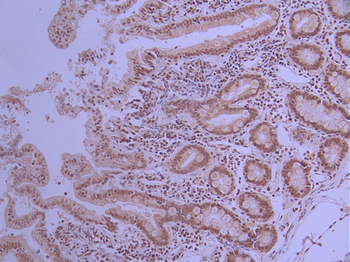 MTA2 Antibody