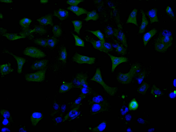 RAB8A Antibody