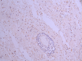 CS Antibody