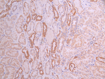CS Antibody