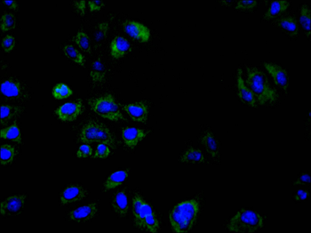 CS Antibody