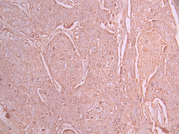 EIF2AK4 Antibody