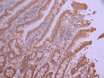 PDCD4 Antibody