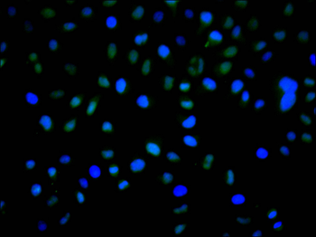 PDCD4 Antibody