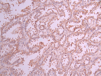 CEACAM6 Antibody