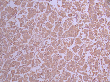 UFC1 Antibody