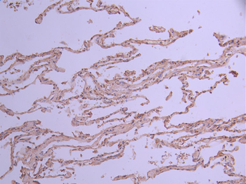 UFC1 Antibody