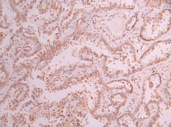HMGB2 Antibody