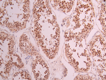 HMGB2 Antibody