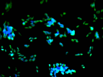 HMGB2 Antibody